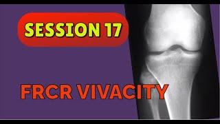 FRCR VIVACITY SESSION 17 [upl. by Nirehs]