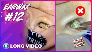 EP 12 Earwax ASMR  The long video of earwax removal is extremely satisfying [upl. by Adnaloj578]