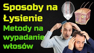 Sposoby na Łysienie i wypadanie włosów  przyczyny i leczenie [upl. by Stimson]