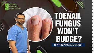 Best Treatment for Toenail Fungus Over 5 Years PodiatristNY ToenailFungus ProvenTreatment [upl. by Kinzer171]