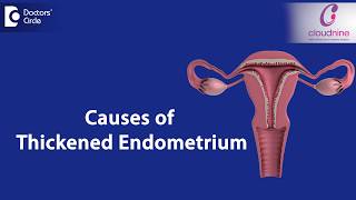 What causes Endometrial thickness  DrSmitha Sha of Cloudnine Hospitals  Doctors Circle [upl. by Sirroned454]