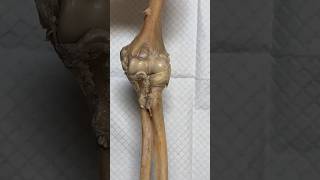 Elbow joint movement medical ortho bone knowledge bihar bio [upl. by Tertius209]