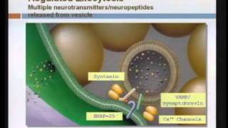 Spasticity Management [upl. by Barbaresi]