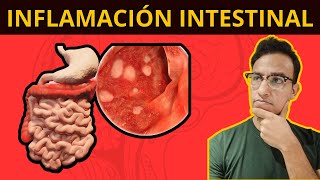 5 COSAS QUE TE INFLAMAN EL INTESTINO Síndrome de Intestino Irritable [upl. by Telocin]