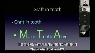 MTA Webinar  Saving natural teeth using MTA [upl. by Brittany]