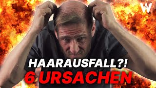 Haarausfall Die 6 häufigsten Ursachen für weniger Haare auf dem Kopf Top Tipps für volleres Haar [upl. by Aened]