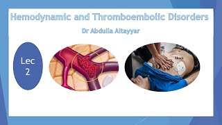 Hemodynamic Disorders and Thromboembolic Disease Lecture2 محاضرة أمراض قلبية متعددة [upl. by Bakerman]