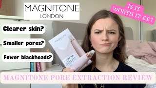 MAGNITONE Pore Extraction System Review  Athome Microdermabrasion dupe [upl. by Lohman]