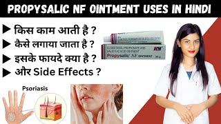 Propysalic Nf Ointment Uses in Hindi  clobetasol propionate and salicylic acid ointment ip 6 ww [upl. by Rahm]