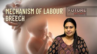 MECHANISM OF LABOURBREECH PRESENTATIONDHANYA DEEPUOBGHIGH RISK LABOUR [upl. by Aidas]