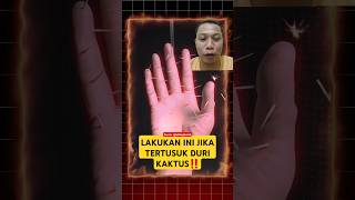 LAKUKAN ini jika tertusuk duri KAKTUS‼️shorts amazingfacts kaktus experiment reaction [upl. by Gaylor]