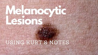 Melanocytic Lesions Kurt’s Notes pathagonia [upl. by Kotto]