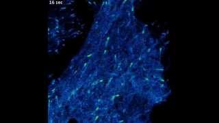 Microtubule Dynamics in a live Cancer Cell [upl. by Htes390]