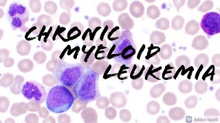 Chronic Myeloid Leukemia CML Peripheral Blood Smear Hematopathology amp Hematology [upl. by Attalanta345]