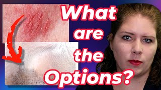 Treatments for Allergies  Vets Voice Atopic Dermatitis Part 2 [upl. by Sorkin575]