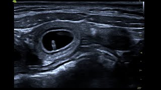 Canine foetal pole imaged on ScanPad and Vinno D6 [upl. by Selym]