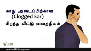 காது அடைப்பிற்கான சிறந்த வீட்டு வைத்தியம்  Home Remedies For Clogged Ears [upl. by Kosak779]