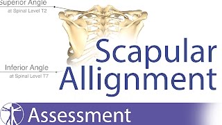 Scapular Alignment and possible causes for dyskinesia [upl. by Carlo]