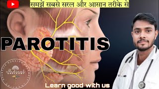 Parotitis  parotitis in hindi  paroted gland swelling  paroted gland or salivary gland infection [upl. by Winfield]