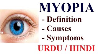 What is Myopia Near or Short sightedness  Causes Symptoms Treatment  Urdu  Hindi [upl. by Akihsan]