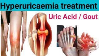 Hyperuricaemia treatment  Uric acid in hindi  Gout uricacid viralvideo [upl. by Enovaj]