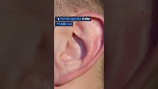 Tinnitus EXPOSED  Surprising Causes of Ringing in Ears 6 [upl. by Affra]