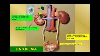 Fisiopatologia de la Infeccion Urinaria [upl. by Nerrak]