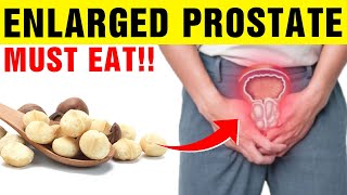 7 Best Foods To Eat in Enlarged Prostate [upl. by Gentes]