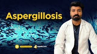 Aspergillosis  Infectious Clinical Medicine  Online Video Lectures  VLearning [upl. by Pollyanna]