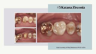 Zirconia 101 10 of 11 Clinical cases [upl. by Jenness]