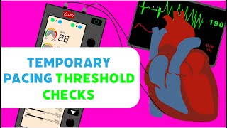 Temporary Pacing Threshold Checks [upl. by Kesia]