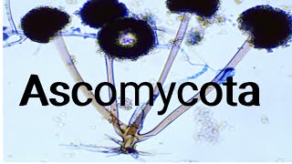 Ascomycota Advance Knowledge 1st year biology [upl. by Enitsirhk]