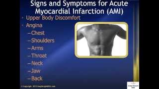 Signs and Symptoms for AMI Acute Myocardial Infarction [upl. by Muryh]