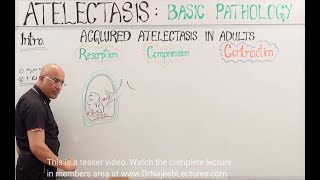 Atelectasis  Resorption Compression and Contraction [upl. by Phillida]