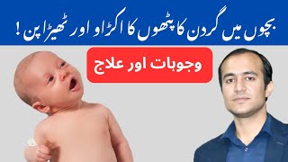 Torticollis in Babies Causes Symptoms and Treatment Options Explained  urdu amp hindi [upl. by Kcirad233]