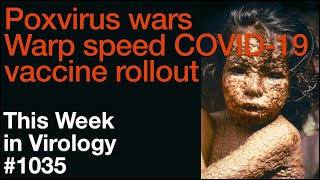 TWiV 1035 Poxvirus wars warp speed COVID19 vaccine rollout [upl. by Trinity251]