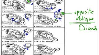 Normal Labor 3 quot Stages of Labour and Partogram quot [upl. by Lew]