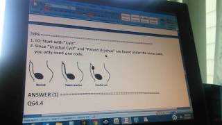 ICD10 JJ10A36310L0 urachal cyst patent urachus [upl. by Nniuq]