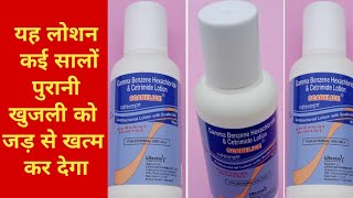 Scabelice Lotion ke use स्कैबलाइस लोशन Ascabiol Lotion Gamma Benzene Hexachloride amp Cetrimide Lotion [upl. by Libre]