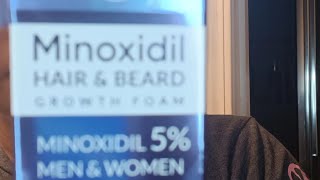 Lets Give Minoxidil A Try 🙏🙏🙏🙏 [upl. by Fleischer]