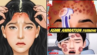 ASMR ANIMATION REMOVEface clear skin doctor [upl. by Anidualc651]