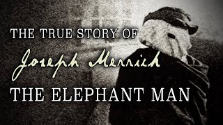 quotThe True Story of Joseph Merrick The Elephant Manquot 1997 [upl. by Rosario746]