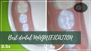 What is the IDEAL MAGNIFICATION in dentistry [upl. by Roose]