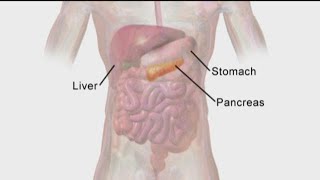 Battling pancreatic cancer  Doctor explains the disease [upl. by Latoya956]