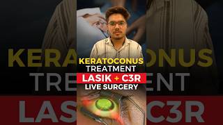 Live Keratoconus Treatment Lasik  C3R [upl. by Auod250]