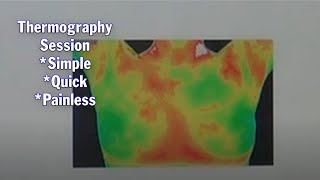 What Is Thermography Testing  What Do You Do And What Should You Expect [upl. by La]