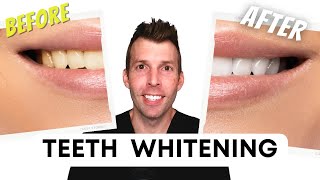 The best way to whiten teeth what really works [upl. by Essilec]