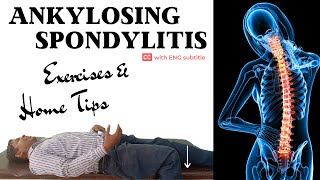 7 Best Ankylosing Spondylitis Exercises to prevent joint stiffness amp muscle tightness [upl. by Templia]