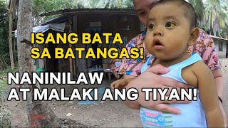 BILIARY ATRESIA BABY NG SAN JUAN BATANGAS  NANINILAW AT MALAKI ANG TIYAN [upl. by Oech]