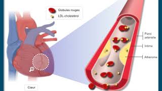 Questce que lathérosclérose [upl. by Dorcas244]